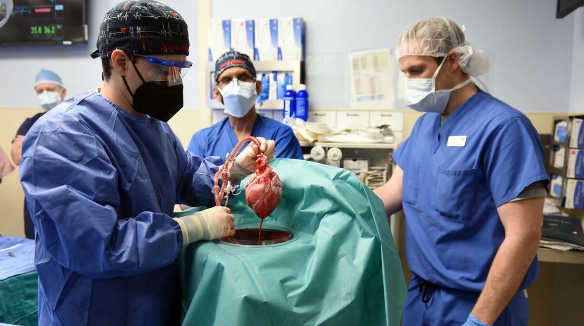 cirugia_del_corazon_de_cerdo_afp